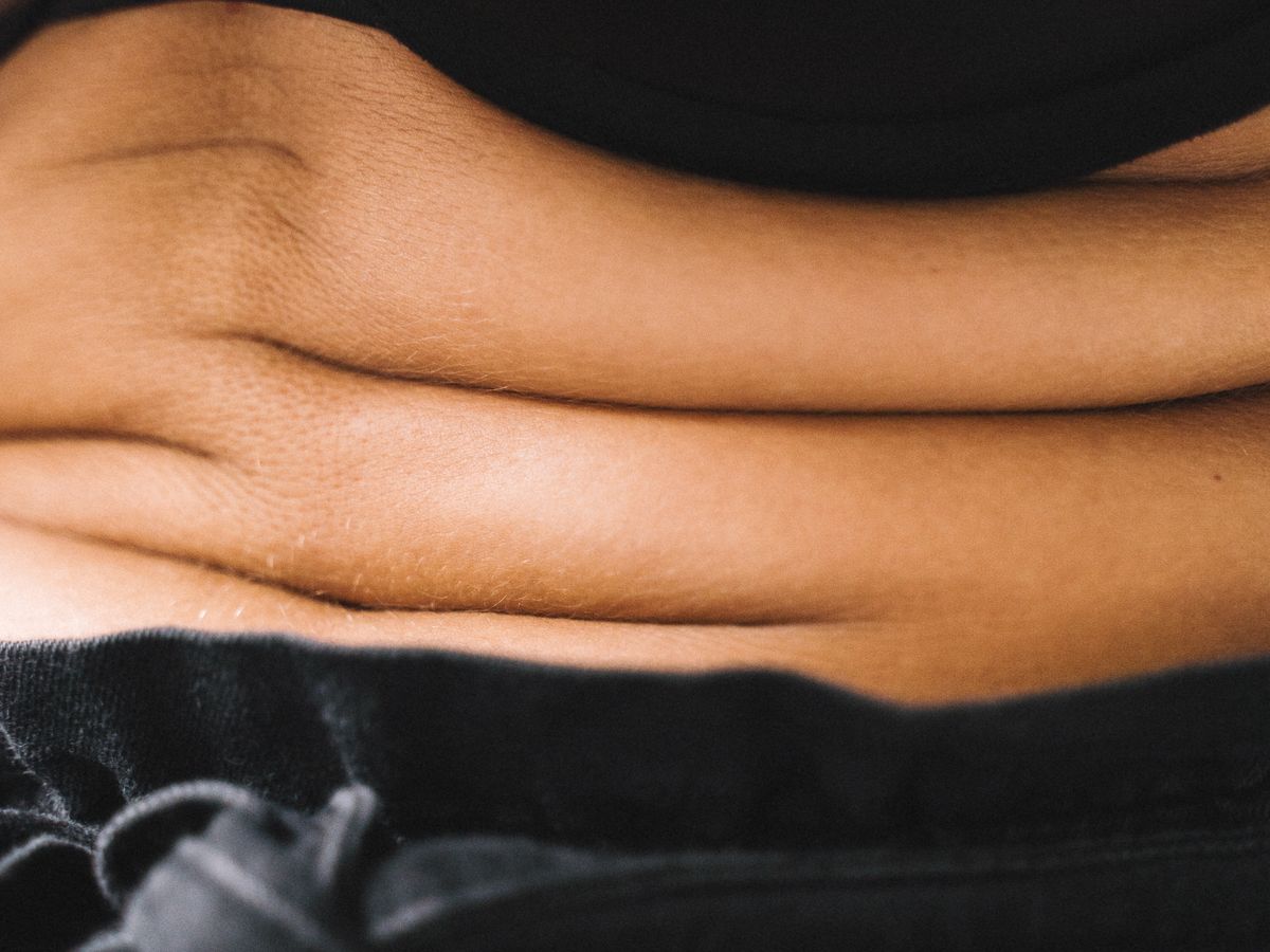 Tratamento para flacidez abdominal