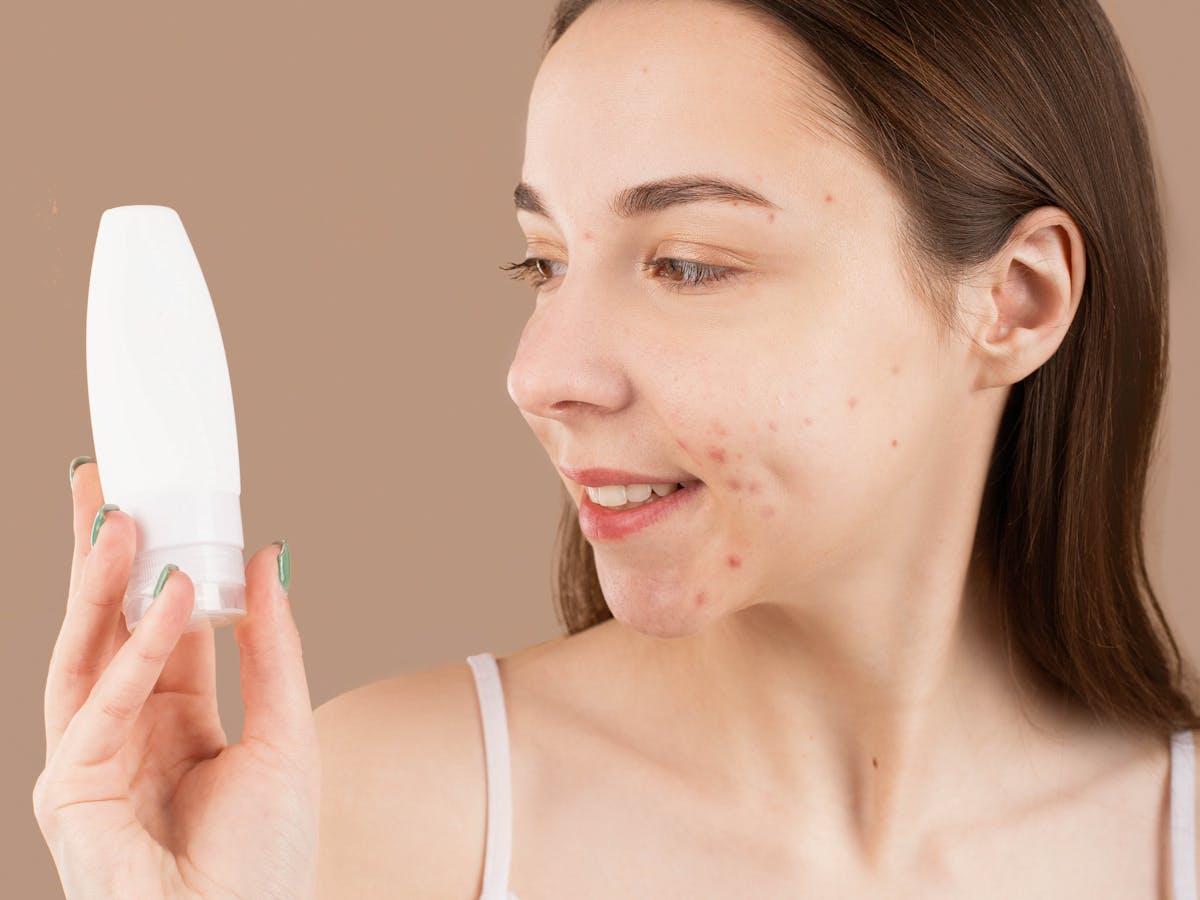 Tratamento de acne